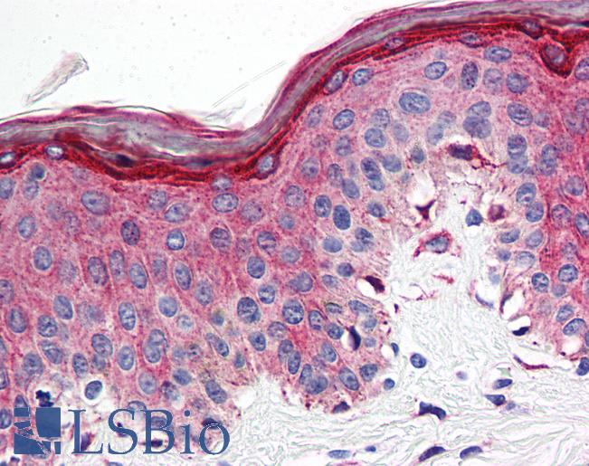 Anti-5HT1E Receptor antibody LS-A2739 IHC of human skin. Immunohistochemistry of formalin-fixed, paraffin-embedded tissue after heat-induced antigen retrieval.