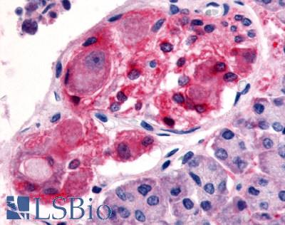 Anti-5HT2C Receptor antibody LS-A1116 IHC of human pancreas, ganglion and Schwann cells. Immunohistochemistry of formalin-fixed, paraffin-embedded tissue after heat-induced antigen retrieval.