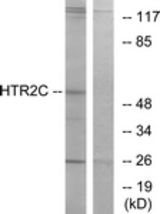 Western blot of extracts from Jurkat cells, using HTR2C Antibody. The lane on the right is treated with the synthesized peptide.