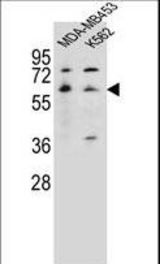 HTR3A Antibody western blot of MDA-MB453,K562 cell line lysates (35 ug/lane). The HTR3A antibody detected the HTR3A protein (arrow).
