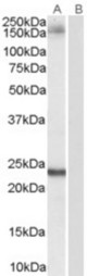 Antibody (0.1 ug/ml) staining of Hela lysate (35 ug protein in RIPA buffer). Primary incubation was 1 hour. Detected by chemiluminescence.