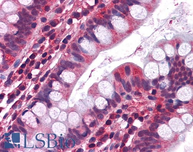Anti-5HT3A receptor antibody IHC of human small intestine. Immunohistochemistry of formalin-fixed, paraffin-embedded tissue after heat-induced antigen retrieval. Antibody LS-B3945 concentration 3.75 ug/ml.