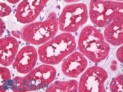 Anti-5HT3B Receptor antibody IHC of human kidney, tubules. Immunohistochemistry of formalin-fixed, paraffin-embedded tissue after heat-induced antigen retrieval. Antibody LS-B7535 concentration 10 ug/ml.