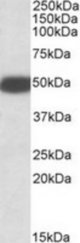 HTR3B antibody (0.1 ug/ml) staining of Rat Brain lysate (35 ug protein/ml in RIPA buffer). Primary incubation was 1 hour. Detected by chemiluminescence.