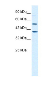 HTR3B / 5-HT3B antibody LS-B971 Western blot of Jurkat lysate.