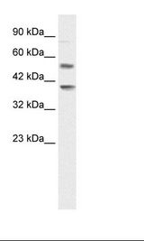 Jurkat Cell Lysate