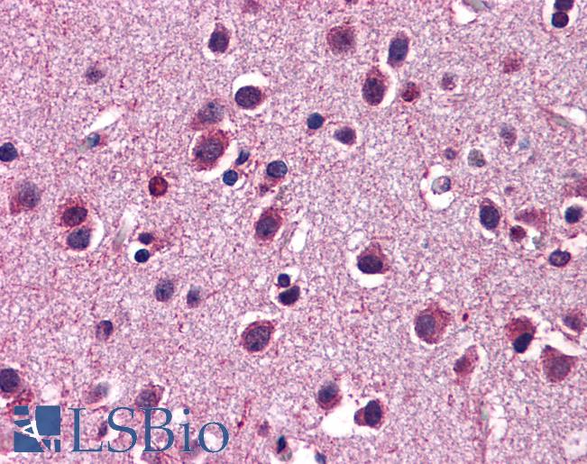 Anti-HTR3C / 5-HT3C antibody IHC of human brain, cortex. Immunohistochemistry of formalin-fixed, paraffin-embedded tissue after heat-induced antigen retrieval. Antibody LS-B5619 concentration 5 ug/ml.