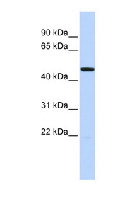 HTR3C / 5-HT3C antibody LS-B5619 Western blot of Fetal Brain lysate.