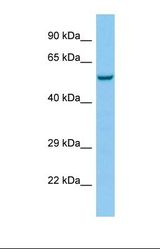 Western blot of Human NCI-H226. HTR3E antibody dilution 1.0 ug/ml.