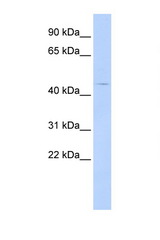 HTR4 / 5-HT34 antibody LS-C112321 Western blot of HepG2 Cell lysate. Antibody concentration 1 ug/ml.