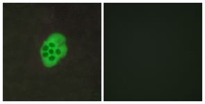 Immunofluorescence of MCF7 cells, using HTR4 Antibody. The picture on the right is treated with the synthesized peptide.