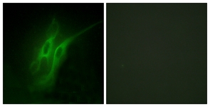 Immunofluorescence of HeLa cells, using 5-HT-4 Antibody. The picture on the right is treated with the synthesized peptide.