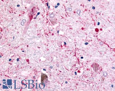 Anti-5HT4 Receptor antibody LS-A656 IHC of human brain, neurons and glia. Immunohistochemistry of formalin-fixed, paraffin-embedded tissue after heat-induced antigen retrieval.