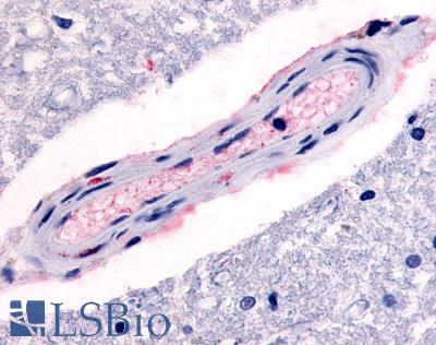 Anti-5HT4 Receptor antibody LS-A657 IHC of human brain, vessel. Immunohistochemistry of formalin-fixed, paraffin-embedded tissue after heat-induced antigen retrieval.