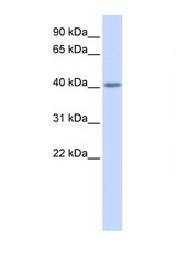 HTR5A / 5-HT35A antibody LS-C102842 Western blot of Fetal Muscle lysate. Antibody concentration 1 ug/ml.