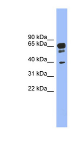 HTR5A / 5-HT35A antibody LS-C115966 Western blot of Fetal Stomach lysate.