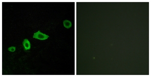 Immunofluorescence of LOVO cells, using HTR5A Antibody. The picture on the right is treated with the synthesized peptide.