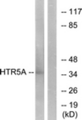 Western blot of extracts from Jurkat cells, using HTR5A Antibody. The lane on the right is treated with the synthesized peptide.