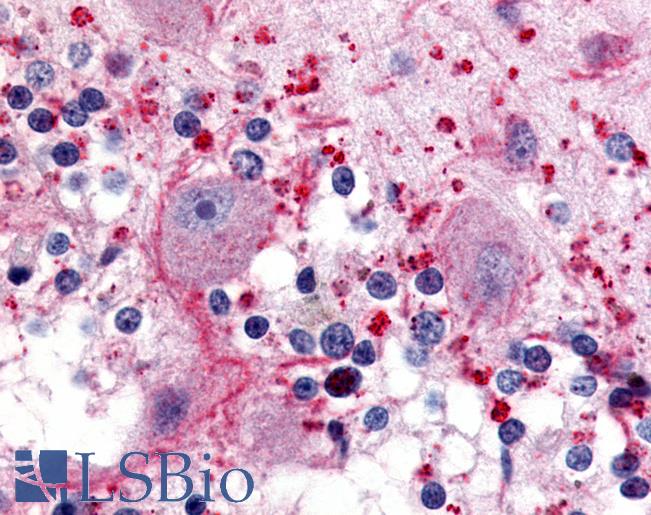 Anti-5HT5A Receptor antibody LS-A6693 IHC of human brain, cerebellum. Immunohistochemistry of formalin-fixed, paraffin-embedded tissue after heat-induced antigen retrieval.