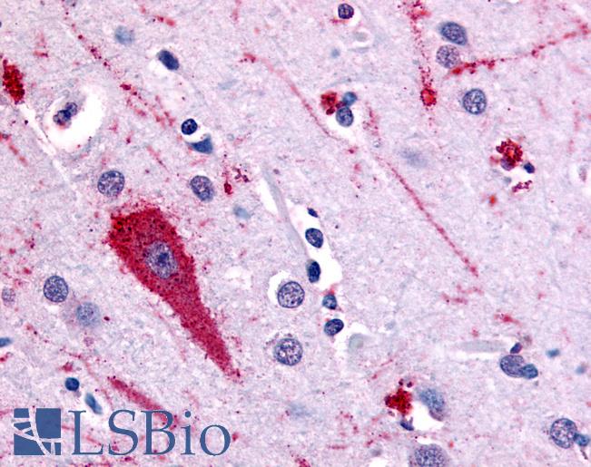 Anti-5HT5A Receptor antibody LS-A2119 IHC of human brain, cortex. Immunohistochemistry of formalin-fixed, paraffin-embedded tissue after heat-induced antigen retrieval.
