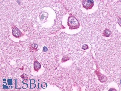 Anti-5HT5A Receptor antibody LS-A2122 IHC of human brain, neurons and glia. Immunohistochemistry of formalin-fixed, paraffin-embedded tissue after heat-induced antigen retrieval.