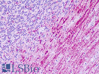 Human, Brain, Cerebellum: Formalin-Fixed Paraffin-Embedded (FFPE)