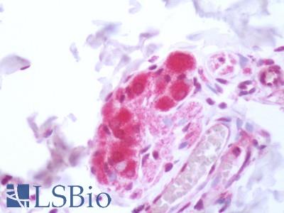 Human Small Intestine: Formalin-Fixed, Paraffin-Embedded (FFPE)