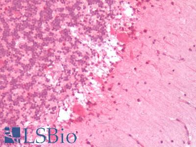 Human Brain, Cerebellum: Formalin-Fixed, Paraffin-Embedded (FFPE)