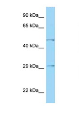 HTRA1 antibody LS-C146185 Western blot of Fetal Kidney lysate. Antibody concentration 1 ug/ml.
