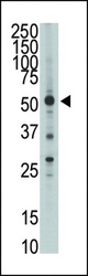 The anti-HtrA1 N-term antibody is used in Western blot to detect HtrA1in mouse brain tissue lysate.