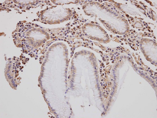 IHC of paraffin-embedded gastric tissue using GOLGA3 antibody at 1:100 dilution.