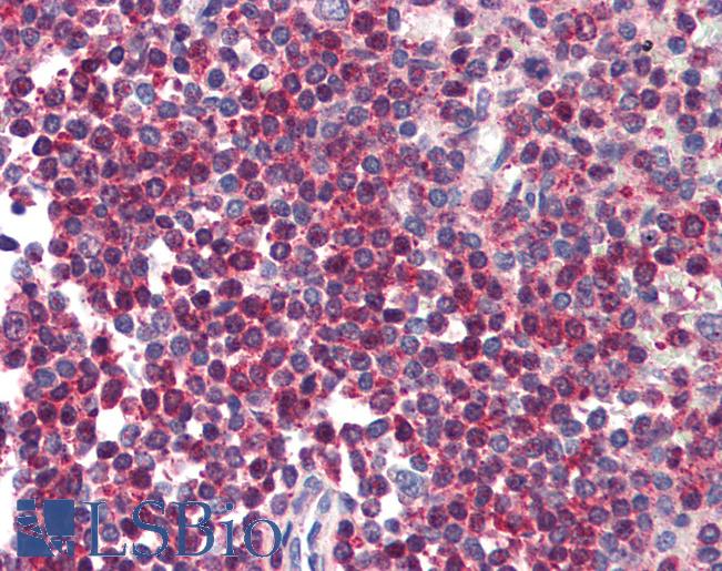Anti-HTRA2 antibody IHC of human spleen. Immunohistochemistry of formalin-fixed, paraffin-embedded tissue after heat-induced antigen retrieval. Antibody LS-B570 concentration 5 ug/ml.