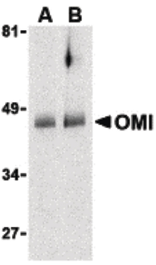 Western blot of OMI in human colon cell lysates with OMI antibody at (A) 0.5 and (B) 1 ug/ml.