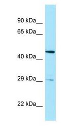 HTRA3 antibody Western Blot of Fetal Brain.