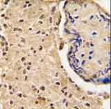 Formalin-fixed and paraffin-embedded human placenta tissue reacted with HtrA3 antibody , which was peroxidase-conjugated to the secondary antibody, followed by DAB staining. This data demonstrates the use of this antibody for immunohistochemistry; clinical relevance has not been evaluated.