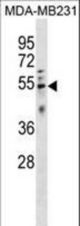 HTRA4 Antibody western blot of MDA-MB231 cell line lysates (35 ug/lane). The HTRA4 antibody detected the HTRA4 protein (arrow).
