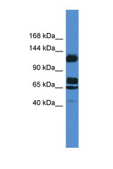 ST5 antibody LS-C135786 Western blot of 721_B Cell lysate. Antibody concentration 1 ug/ml.