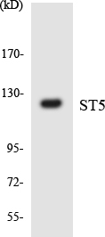 Western blot of the lysates from COLO205 cells using ST5 antibody.
