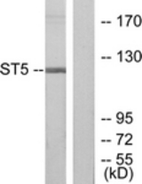 Western blot of extracts from COLO205 cells, using ST5 Antibody. The lane on the right is treated with the synthesized peptide.