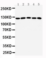 WB of HTS1 / ST5 antibody. All lanes: Anti-ST5 at 0.5ug/ml. Lane 1: Rat Testis Tissue Lysate at 40ug. Lane 2: A431 Whole Cell Lysate at 40ug. Lane 3: HELA Whole Cell Lysate at 40ug. Lane 4: COLO320 Whole Cell Lysate at 40ug. Lane 5: NIH Whole Cell Lysate at 40ug. Predicted bind size: 126KD. Observed bind size: 126KD.