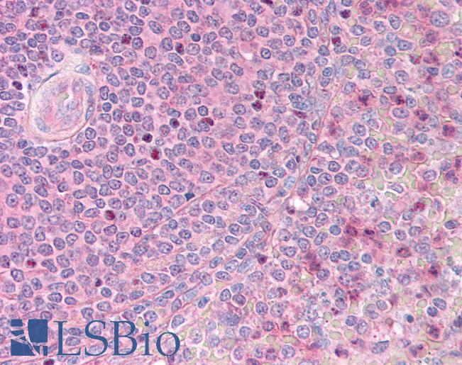 Anti-ST5 antibody IHC of human spleen. Immunohistochemistry of formalin-fixed, paraffin-embedded tissue after heat-induced antigen retrieval. Antibody LS-B905 concentration 5 ug/ml.