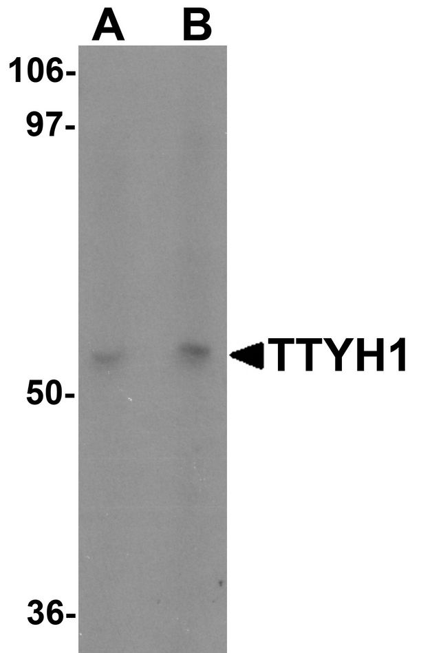 Western blot analysis of TTYH1 in Raji cell lysate with TTYH1 antibody at (A) 1 and (B) 2 ug/ml.