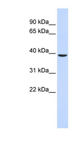 C2orf60 antibody LS-C102380 Western blot of Fetal Muscle lysate.