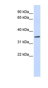 C2orf60 antibody LS-C111306 Western blot of Placenta lysate.