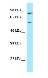 HUFI-2 / LRRFIP2 antibody Western Blot of 721_B.