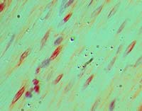 IHC of LRRFIP2 in formalin-fixed, paraffin-embedded human colon tissue using LS-C148719 at 5 ug/ml.
