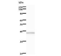 Western blot analysis of immunized recombinant protein, using anti-LRRFIP2 monoclonal antibody.