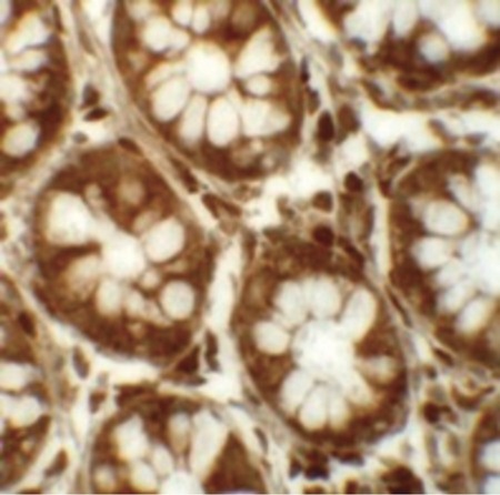 Immunohistochemistry of LRRFIP2 in human colon tissue with LRRFIP2 antibody at 5 ug/ml.