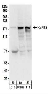 Detection of Mouse RENT2 by Western Blot. Samples: Whole cell lysate from mouse NIH3T3 (50 ug), TCMK-1 (50 ug), and 4T1 (50 ug) cells. Antibodies: Affinity purified rabbit anti-RENT2 antibody used for WB at 1 ug/ml. Detection: Chemiluminescence with an exposure time of 10 seconds.