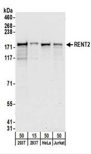 Detection of Human RENT2 by Western Blot. Samples: Whole cell lysate from 293T (15 and 50 ug), HeLa (50 ug), and Jurkat (50 ug) cells. Antibodies: Affinity purified rabbit anti-RENT2 antibody used for WB at 0.4 ug/ml. Detection: Chemiluminescence with an exposure time of 30 seconds.